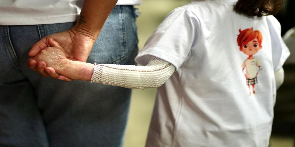 Epidermólise Bolhosa: Programa ‘Santa Catarina Cuidando das Borboletas’ completa um ano da sua implantação